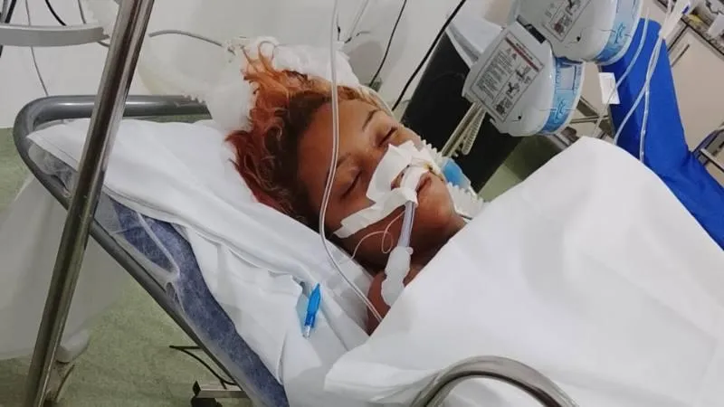 Mulher é espancada pelo marido e luta pela vida em VG